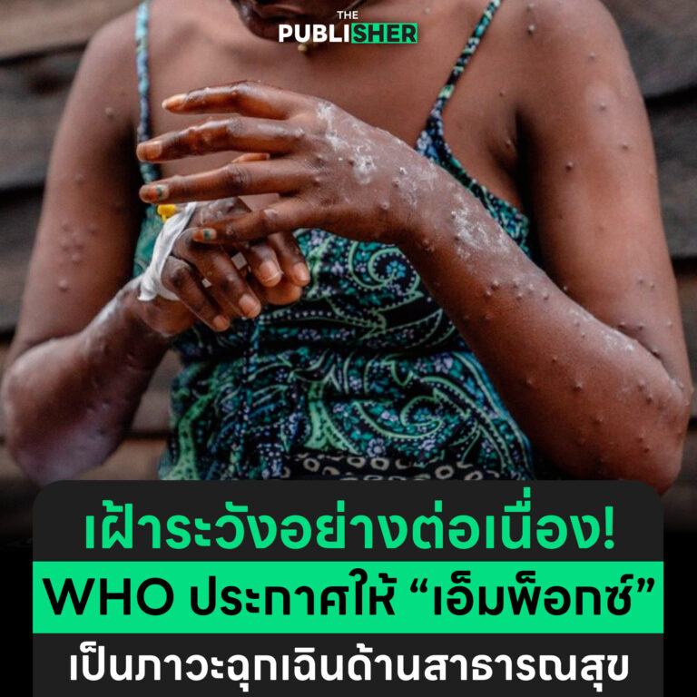 เฝ้าระวังอย่างต่อเนื่อง ! WHO ประกาศให้ “เอ็มพ็อกซ์” เป็นภาวะฉุกเฉินด้านสาธารณสุข