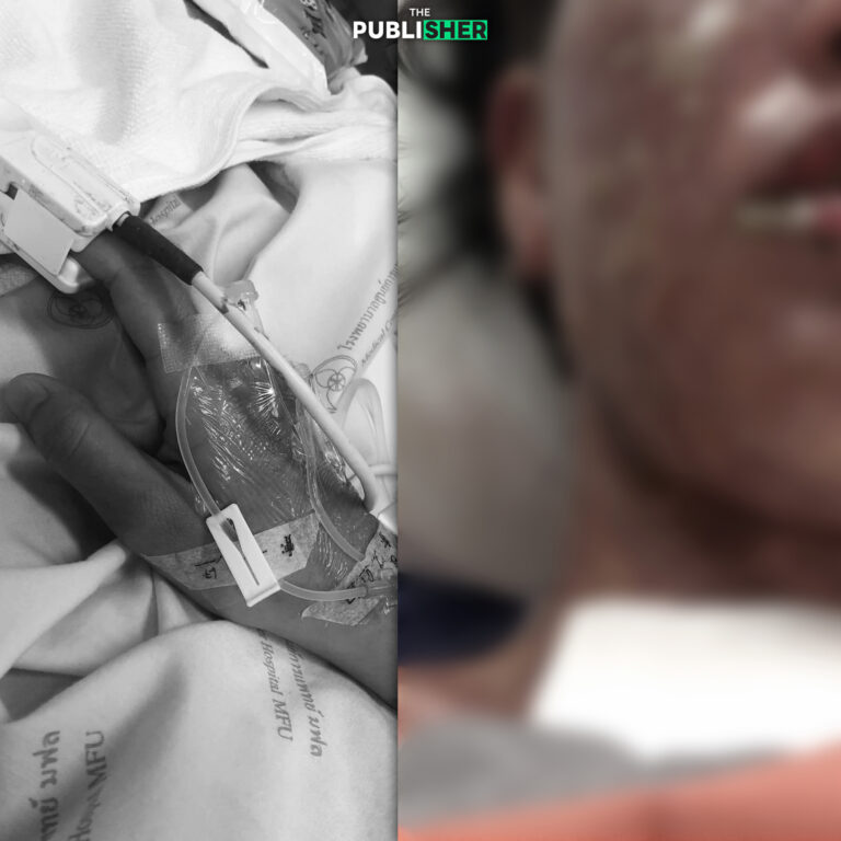 แพ้ยาแก้ปวดรุนแรง เกือบเอาชีวิตไม่รอด